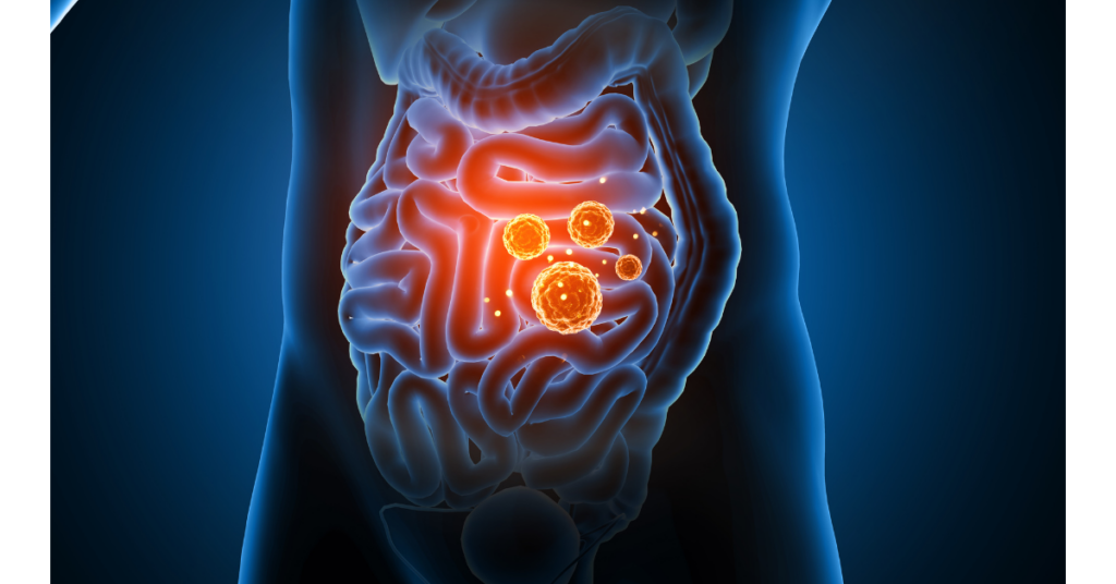 Leaky Gut Syndrome